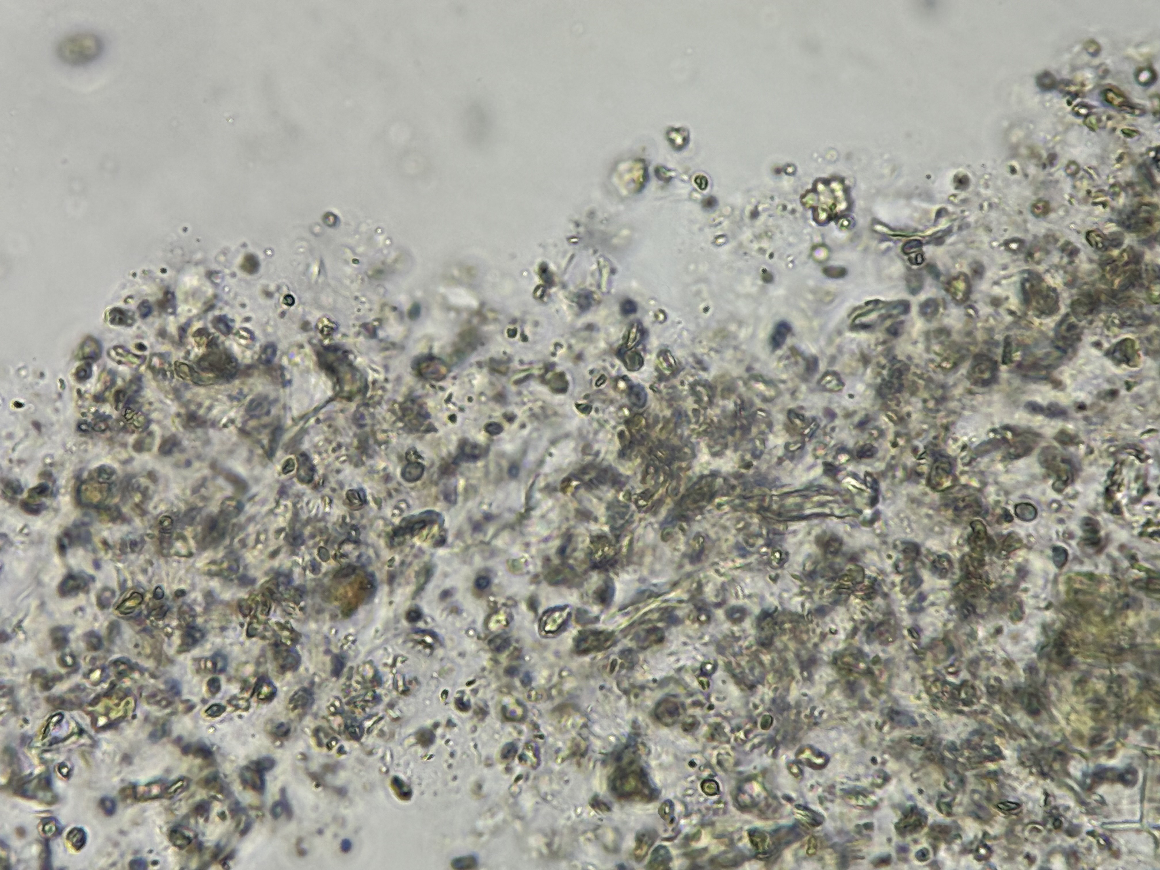 Microscopic image of broken kelp cells